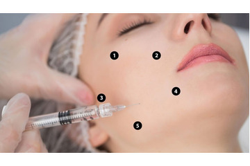 Tiêm BAP là gì? Những lợi ích của tiêm BAP dưới góc nhìn chuyên môn của Bác sĩ Khánh Huệ